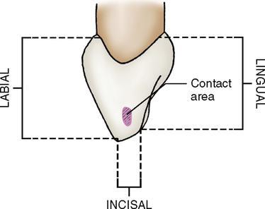 The crown is wedge shaped or triangular with the base of the triangle at the cervix and the apex at the incisal ridge. A line which bisects the crown will bisect the root.
