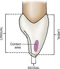 There is little difference between mesial & distal outline.