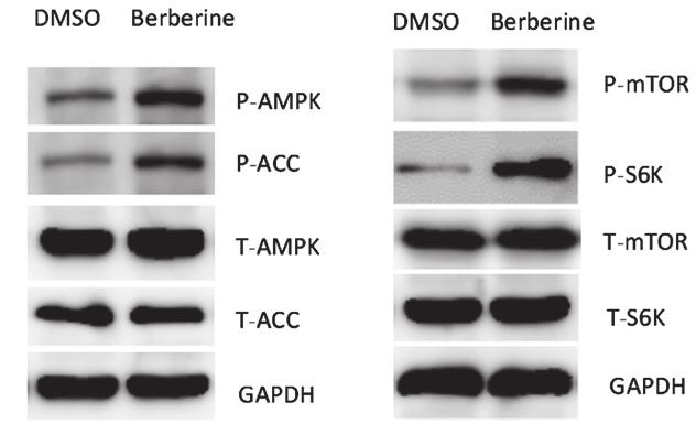 DMSO, dimethyl sulfoxide. GAPDH was used as a loading control. ** P<0.01; *** P<0.001. Figure 3. Berberine induces AMPK activation in Wilms' tumor cells.