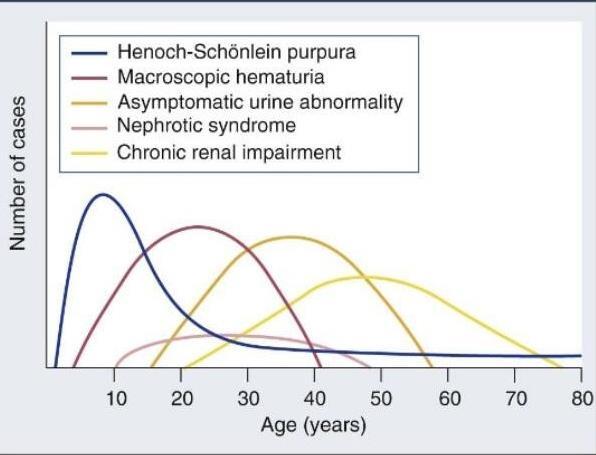 Recurrent macroscopic hematuria Coincides with mucosal infection