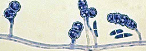 Fusarium solani complex Morphological Description: Colonies growing rapidly, 4.5 cm in four days, aerial mycelium white to cream, becoming bluish-brown when sporodochia are present.