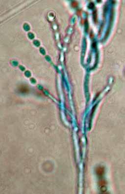 Conidia are subspherical, ellipsoidal to fusiform, hyaline to yellow, smooth-walled, 3-5 x 2-4 µm and are produced in long divergent chains.