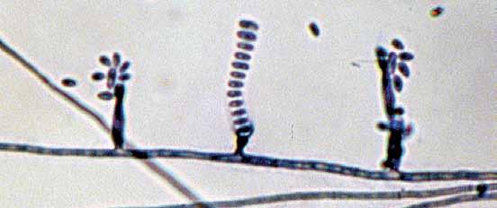 Descriptions of Medical Fungi 155 The genus Phialophora contains more than 40 species, most are saprophytes commonly found in soil or on decaying wood.
