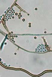 RG-2 organism. Morphological Description: Colonies grow rapidly, and are powdery to woolly or tufted, greyish-brown with a grey-brown to olivaceous-black reverse.
