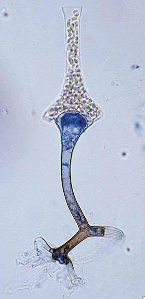 Descriptions of Medical Fungi 177 Saksenaea vasiformis Saksena 15 µm Saksenaea vasiformis showing a typically flask-shaped sporangium.