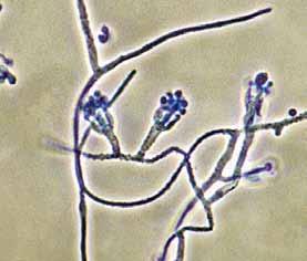 a b 5 µm c 15 µm 5 µm c Talaromyces marneffei (a)
