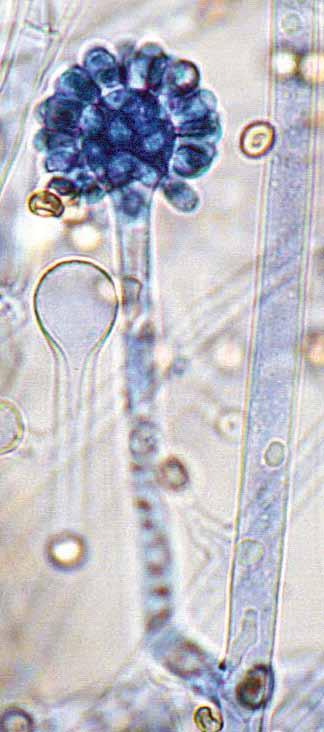 sporangiophores forming a swollen, terminal vesicle around which