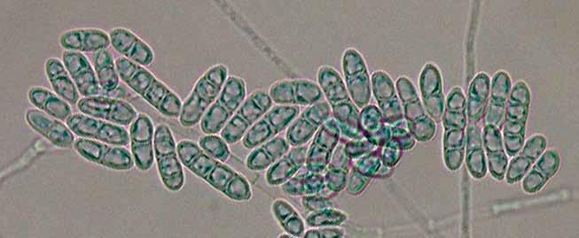 Descriptions of Medical Fungi 79 Cylindrocarpon Wollenw. The genus contains 35 species, mostly from soil and as an occasional human and animal pathogen.