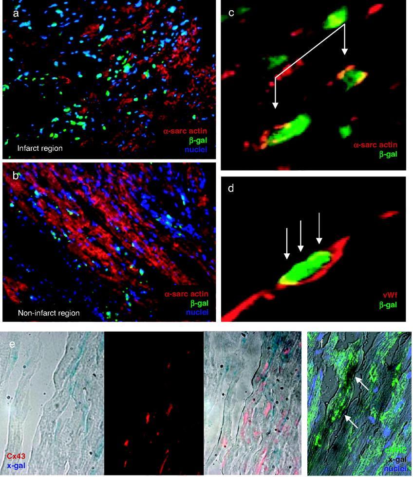 Injection of CDCs in mouse heart Immunofluorescence after 20 days