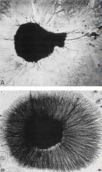 50. Rita Levi-Montalchini won a Nobel Prize for studying the affect of what substance that altered this dorsal root ganglion?