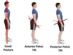 Bad posture is characterised by two