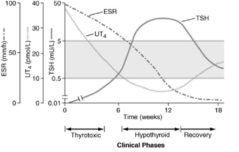 Clinical Course of Sub Acute Thyroiditis Last Comments Thyroid disease is the second most common endocrine disorder It is frequently diagnosed late A significant potential for