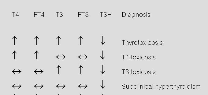SUBCLINICAL HYPERTHYROIDISM Serum TSH below the lower limit of the reference range combined with free T4 and T3 concentrations that are normal Potentially increase risk to develop cardiac and bone