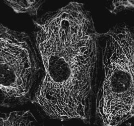 CYTOSKELETON Gives the cell its shape and supports organelles Moves things