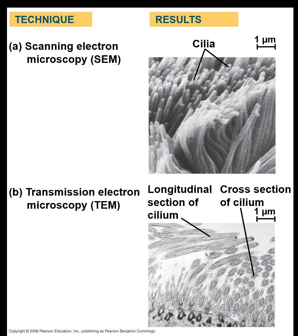 Two basic types of electron microscopes (EMs) are used to study subcellular structures Micrographs Scanning electron microscopes (SEMs) focus a beam of electrons onto the surface of a specimen that