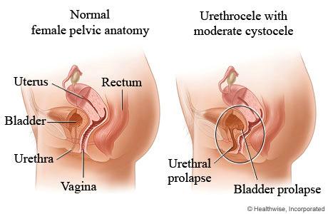 Urethra Tube (3-4cm) in