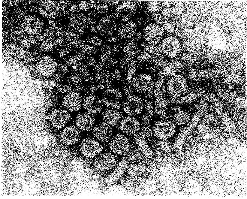 Electron Microscopy: HBV in