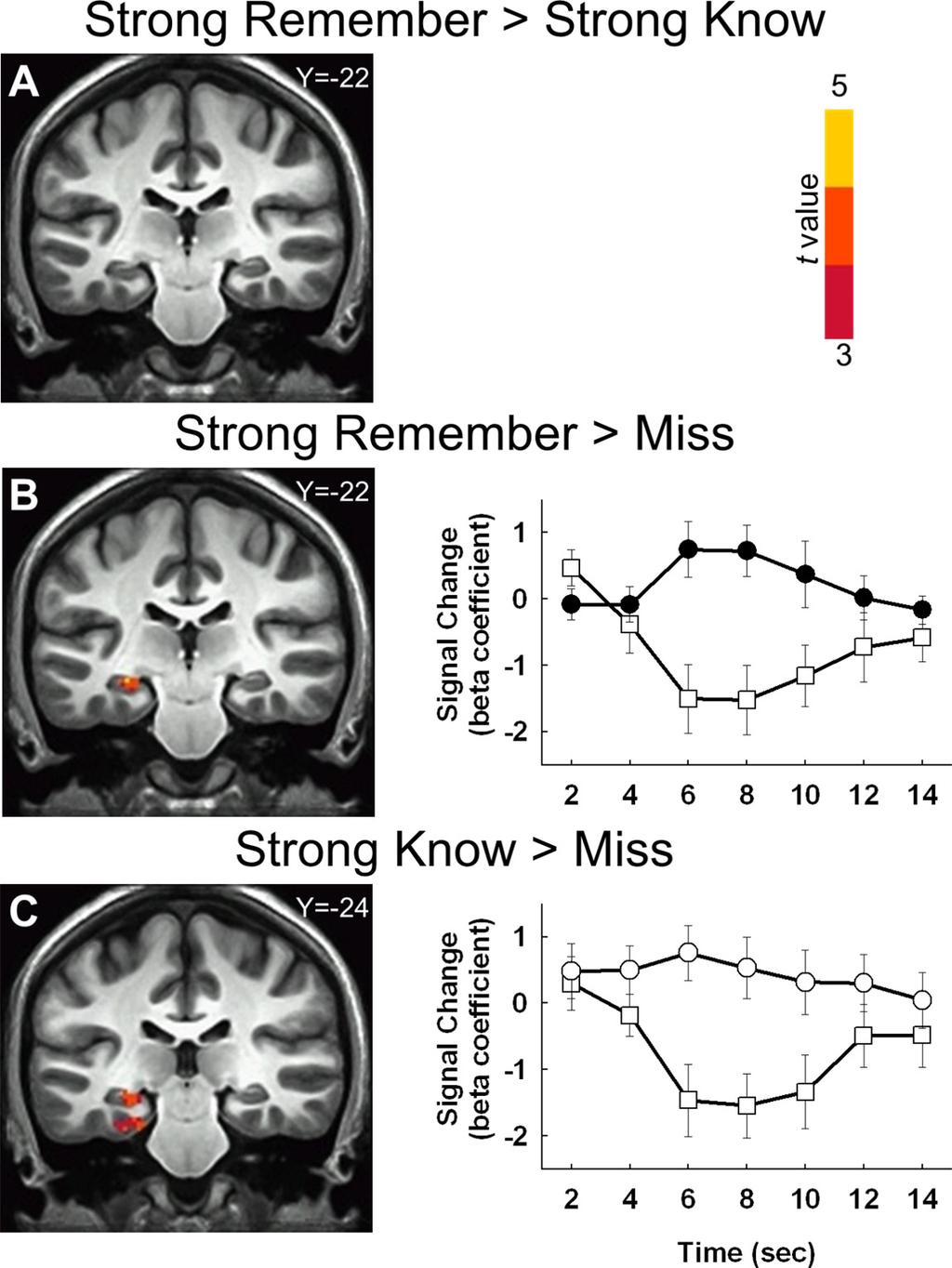 15698 J. Neurosci., November 2, 2011 31(44):15693 15702 Smith et al. Hippocampus and Strong Familiarity ber judgments made with low confidence (see Materials and Methods, fmri data analysis, above).