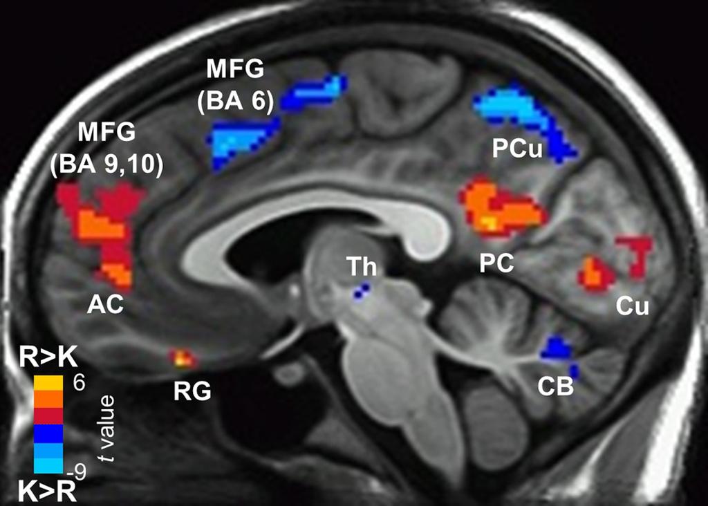 Smith et al. Hippocampus and Strong Familiarity J. Neurosci., November 2, 2011 31(44):15693 15702 15699 Figure 7.