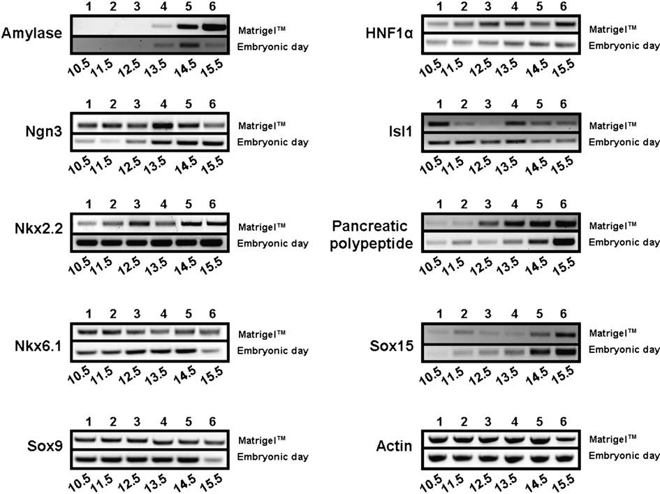 86 S. Puri, M. Hebrok / Developmental Biology 306 (2007) 82 93 Fig. 2. Pancreatic bud expansion in vitro mimics in vivo marker expression.