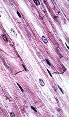 ) Skeletal muscle Smooth muscle Cardiac muscle Figure 1. Photomicrographs of three types of muscle tissue. Muscles are composed of many muscle cells that are also called muscle fibers.