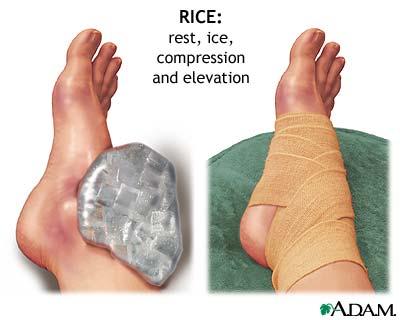 Sprains, Strains, Bumps and Cuts Sprains are ligament and tendon injuries Strains are muscular injuries