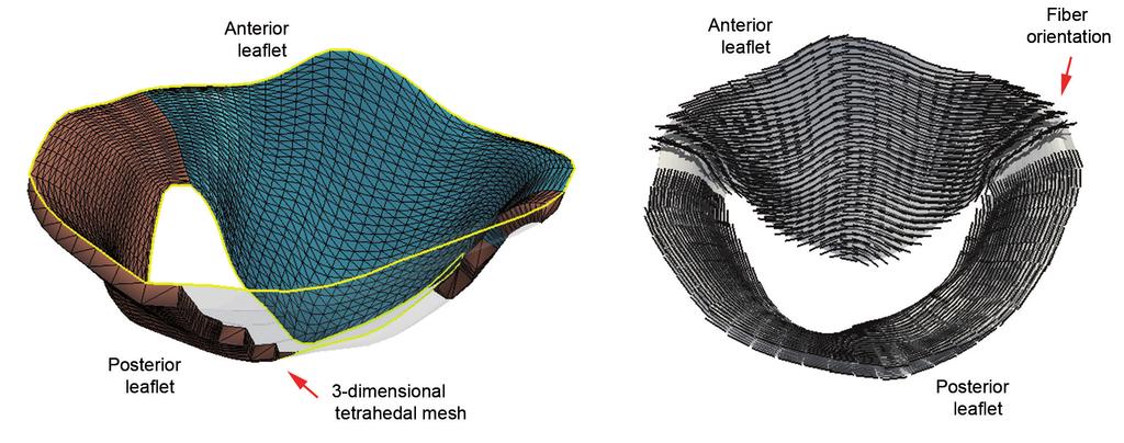 nnals of cardiothoracic surgery, Vol 2, No 6 November 2013 793 Figure 5 Structural models of MV. () 3-dimensional tetrahedal mesh of MV leaflets; () Structural model of MV fiber orientation.