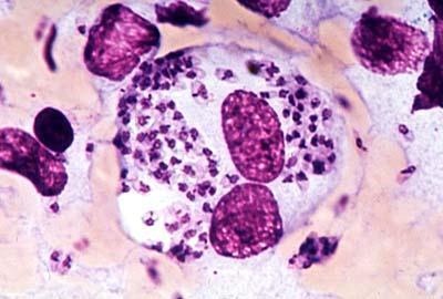 Macrophages infected with Leishmania parasites (Liver; Spleen; Bone Marrow) Dinitroanilines Commercial (TFL)