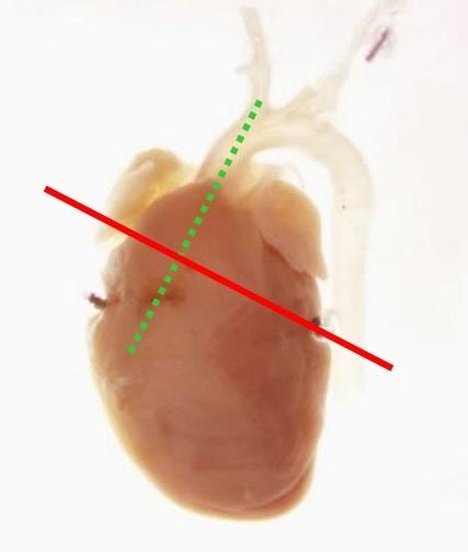 7. Cut the descending aorta at the heart level and dissect away from the backbone. 8. Cut around the heart and aortic branches to free it from all connective tissue.