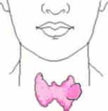 Thyroid nodules About t 5% of women and 1% of men have palpable nodules Increasing
