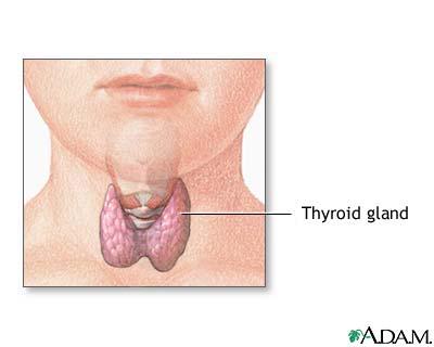 Thyroid cancer risk - Exam Hard, gritty, fixed Enlarged lymph nodes in the lateral neck, posterior triangle or