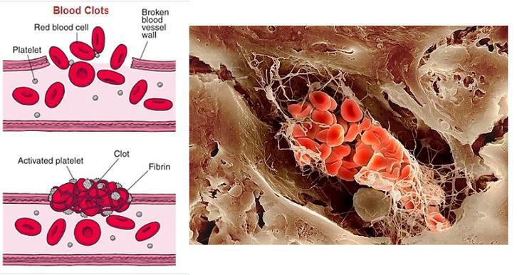 The platelets also interact with fibrinogen, a soluble plasma protein, to form insoluble fibrin. Calcium is required for that.
