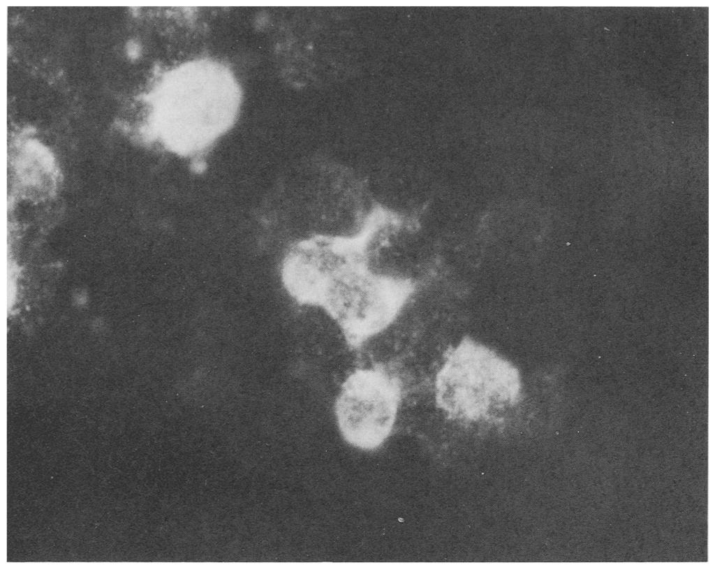 Nodamura virus in mosquitoes 179 Fig. I. AP-6I cells infected with Nodamura virus and examined by IFAT. The cluster in the foreground contains both antigen-positive and antigen-negative cells.