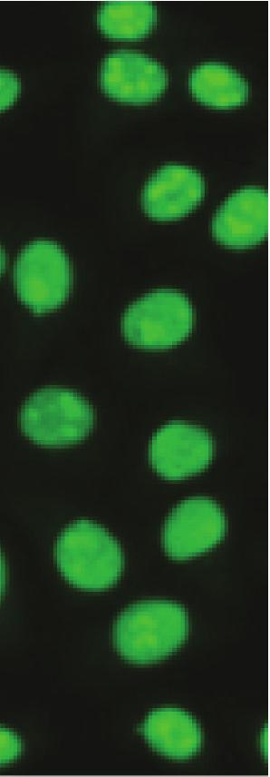 homogeneous patterns generated by anti-scl-70 antibodies, and from (c) homogenous patterns generated by anti-dsdna antibodies.