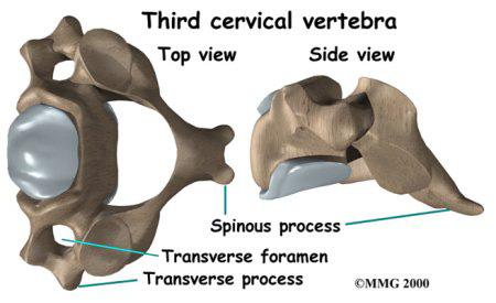 Each vertebra is formed by a round block of bone, called a vertebral body. A bony ring attaches to the back of the vertebral body.