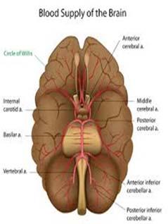 side Most common arteries affected: Internal