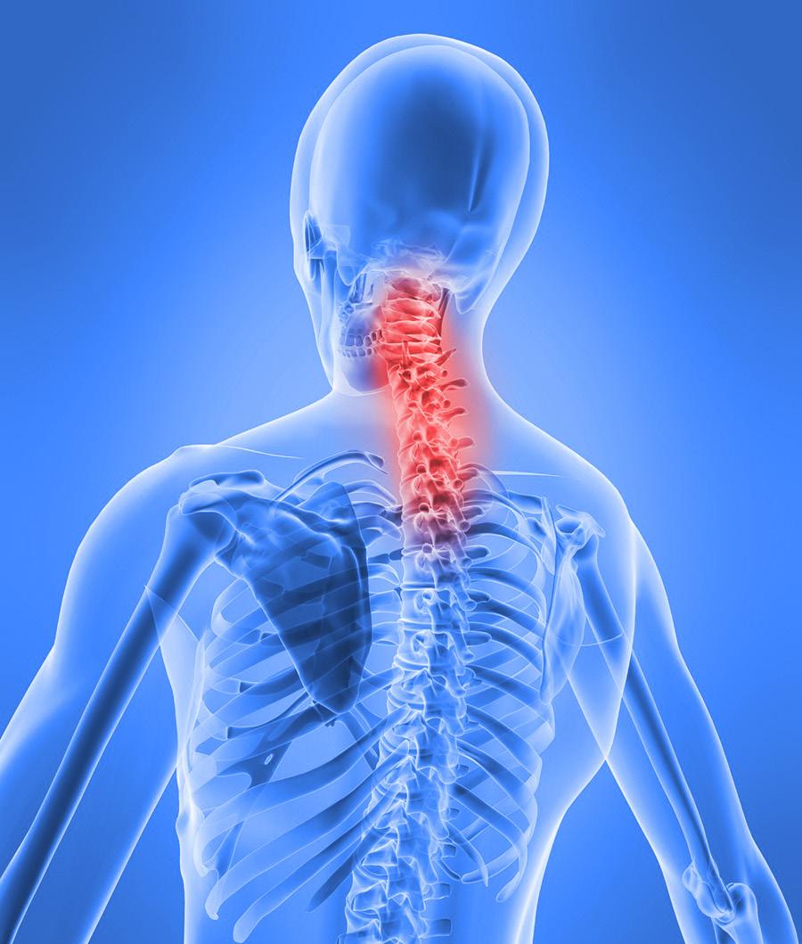 Degenerative Cervical Myelopathy A guide for patients and families of the Spine Program, Toronto Western Hospital This guide gives you important information about: what Degenerative Cervical