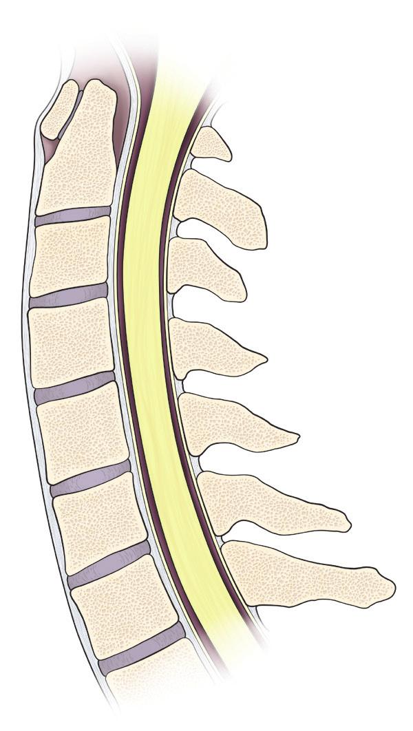 Parts of the spine Inside the cervical vertebrae Skull Spinal cord (passes through a space inside the vertebrae) Ligaments Cervical vertebrae Cervical vertebrae Disc Thoracic vertebrae Lumbar