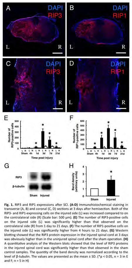 Significance: The expressions of RIP3 and RIP1 were dramatically increased at the lesion site and may contribute to induction of necroptosis as novel cell death