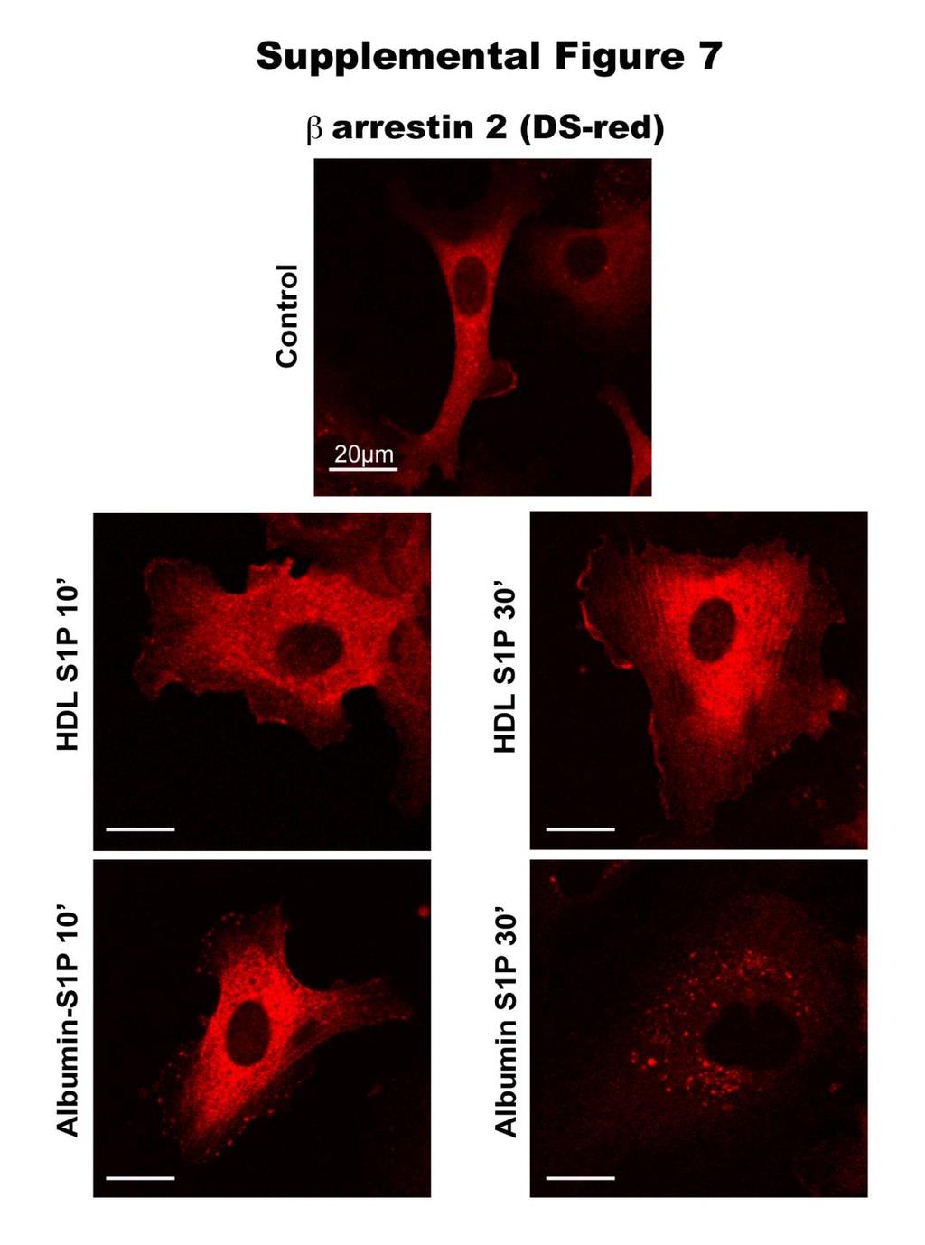 Supplemental Figure 7. Subcellular localization of arrestin 2 depends on the S1P carrier. HUVECs were transduced with lentivirus vector for the expression of DS-Red-tagged arrestin-2.