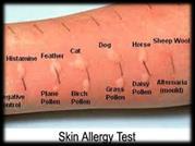 allergens on skin Hay fever - allergens in