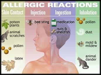 Allergies involve a particular type of antibody