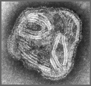 Coronavirus Paramyxovirus Family: Coronaviridae (+)