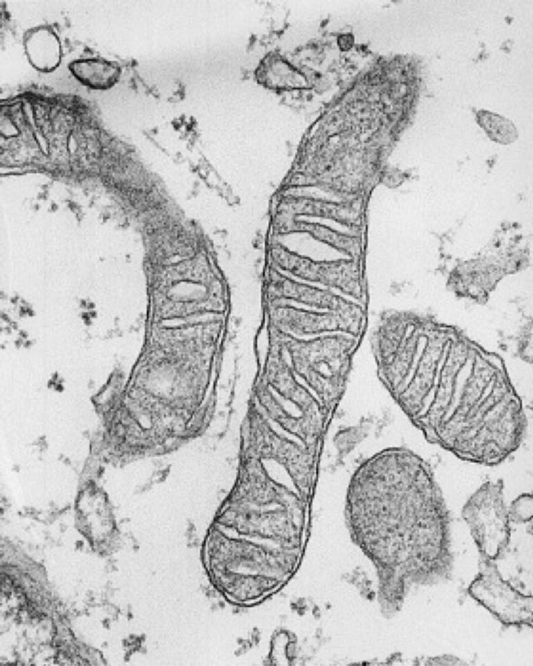 (b) The photograph below shows a group of mitochondria in a liver cell, as seen using an electron microscope. The magnification is 50 000.