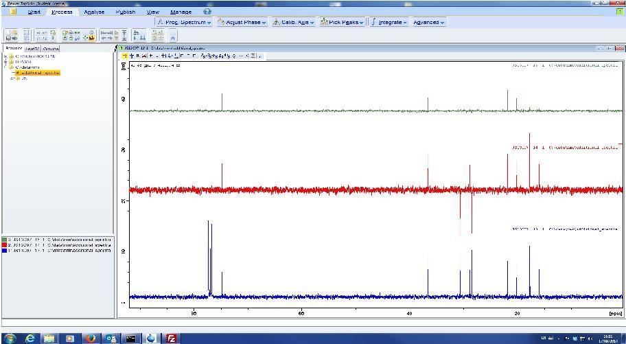 Multiple display function This function allows multiple spectra to be compared In this case the CARBON-13 and DEPT 135,