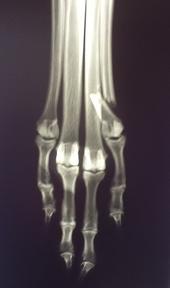 METACARPUS and METATARSUS Metatarsal bone III fractures 18 cases of MT3 fractures were seen in the right metatarsus.