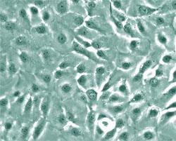 Stem Cells in Placental Tissue Stem Cells Amniotic epithelial cells (haec)