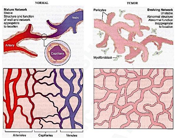 additional mutations Cell with mutation or loss of p53! Angiogenesis is a process of tumors stimulate the growth of host blood vessels (neovascularization).