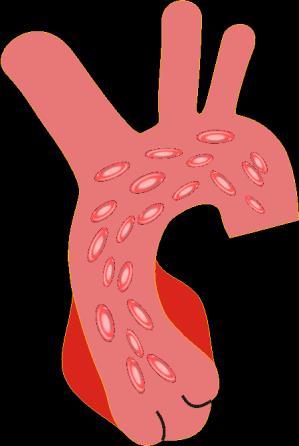blood cells are orientated randomly Aortic valve opens Blood flow in the aorta