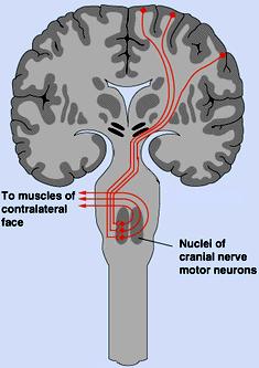 2. tract: - similar to corticospinal tract except axons of primary
